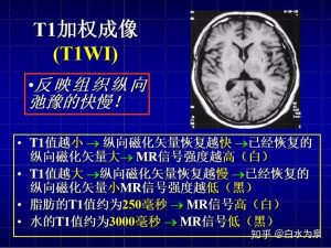 磁共振t1t2信号记忆顺口溜-