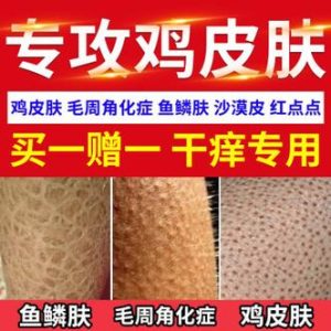 去鸡皮肤产品排行榜-